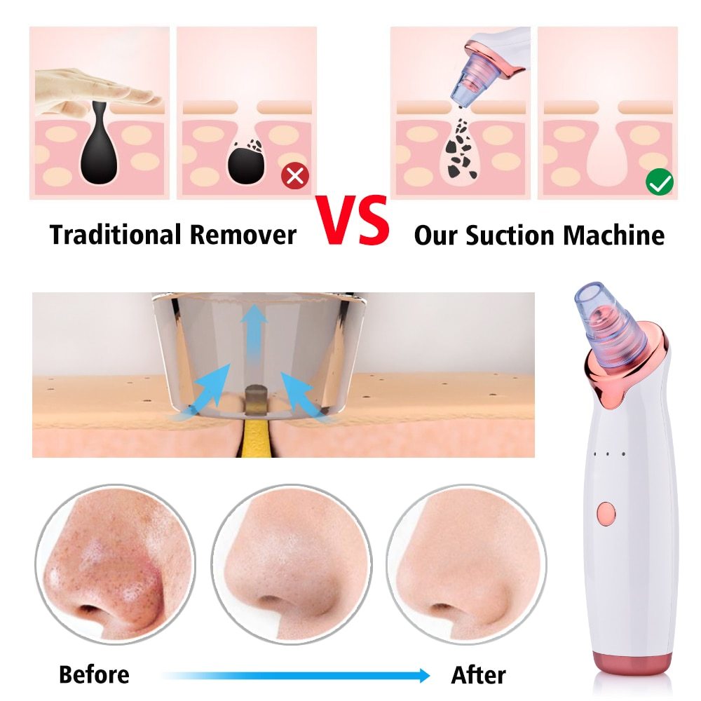 Electric Suction Facial Washing Instrument , Acne Cleaning Blackhead Suction Instrument