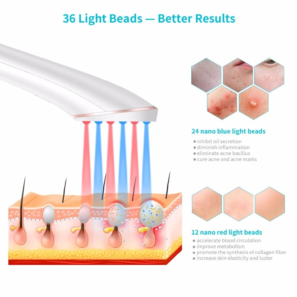 Acne Light Therapy Wireless Treatment Device