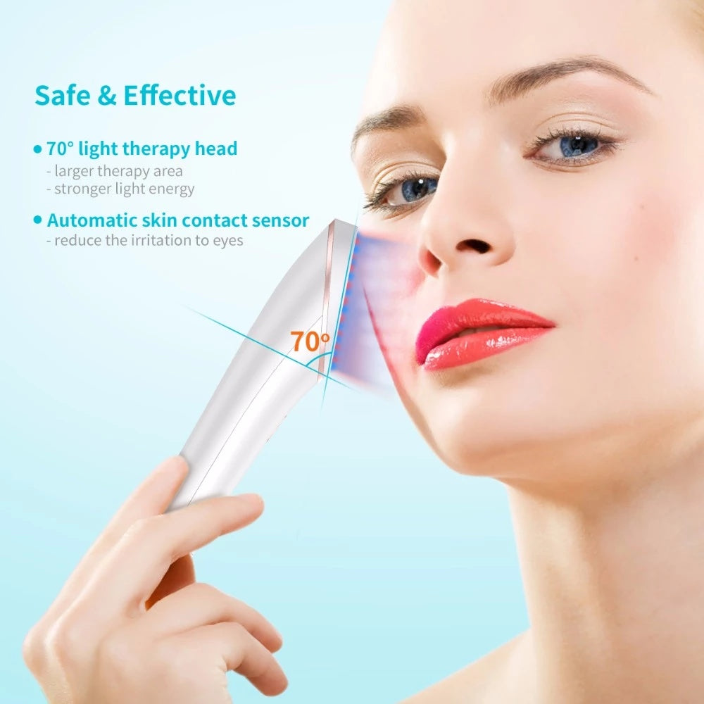 Acne Light Therapy Wireless Treatment Device