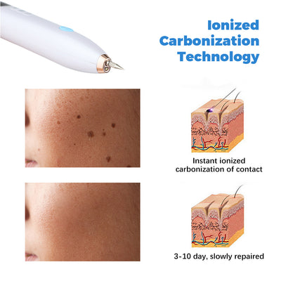 Laser Skin Tag Remover Face Mole and Freckle Removal Pen