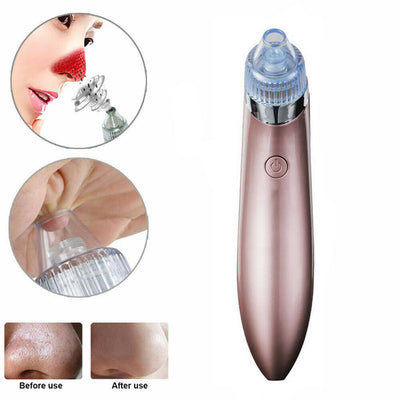 Electric Blackhead Vacuum Pore Cleaner and Acne Pimple Remover