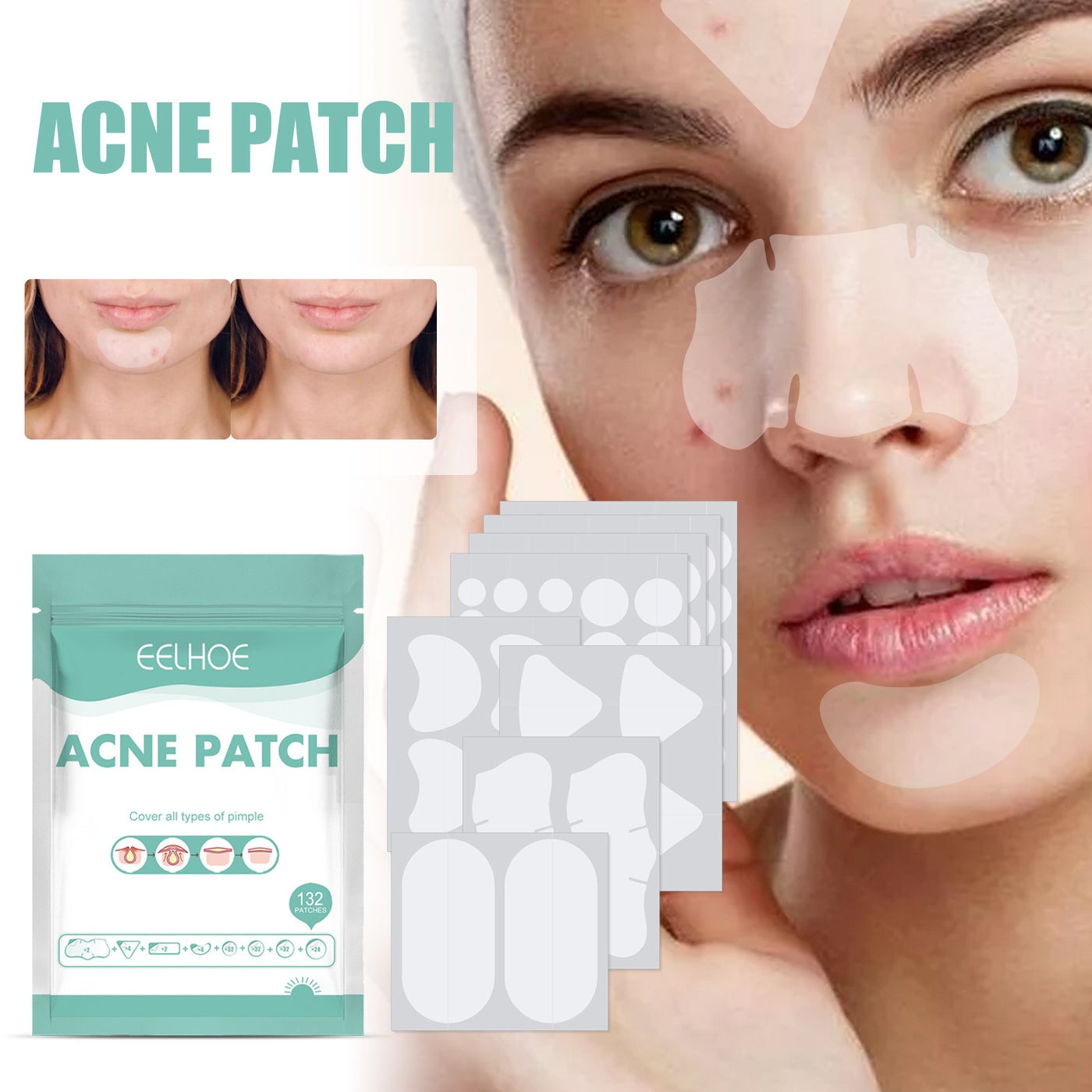 EELHOE Acne Relief Mask Patch