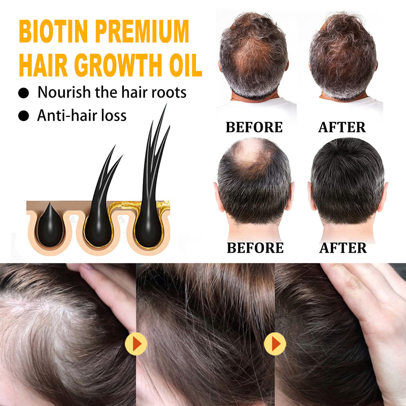 Biotin Hair Treatment Oil Deeply Moisturizing Scalp Massage