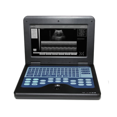 Digital Laptop Ultrasound Scanner