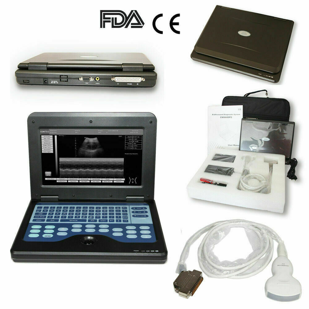 Digital Laptop Ultrasound Scanner