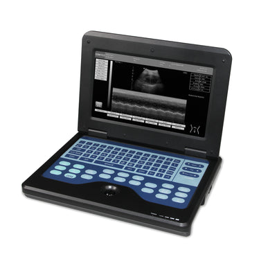 Digital Laptop Ultrasound Scanner