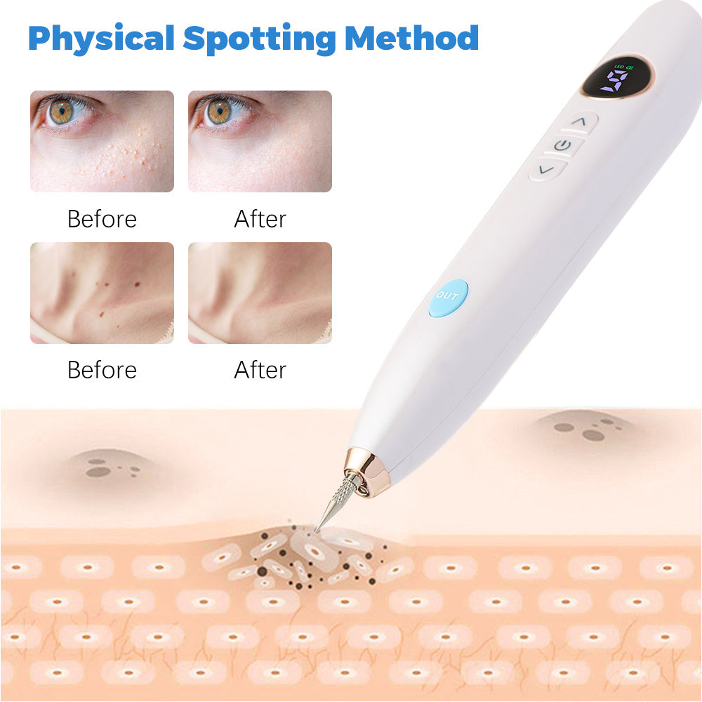 Laser Skin Tag Remover Face Mole and Freckle Removal Pen