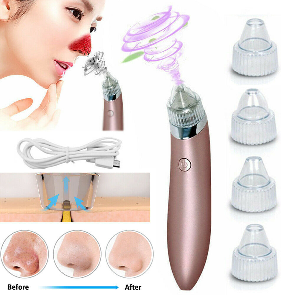 Electric Blackhead Vacuum Pore Cleaner and Acne Pimple Remover